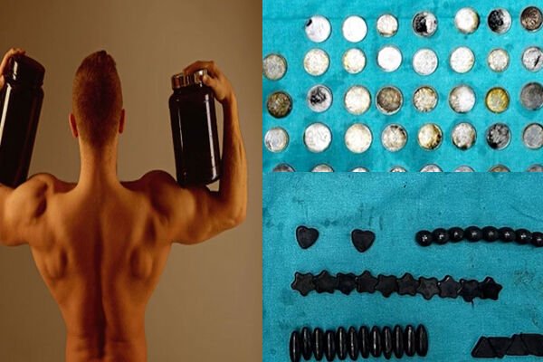 Delhi News: OMG: बॉडी बनाने का ऐसा फितूर, युवक ने निगल लिए 39 सिक्के और 37 चुंबक, फिर हुआ ये…