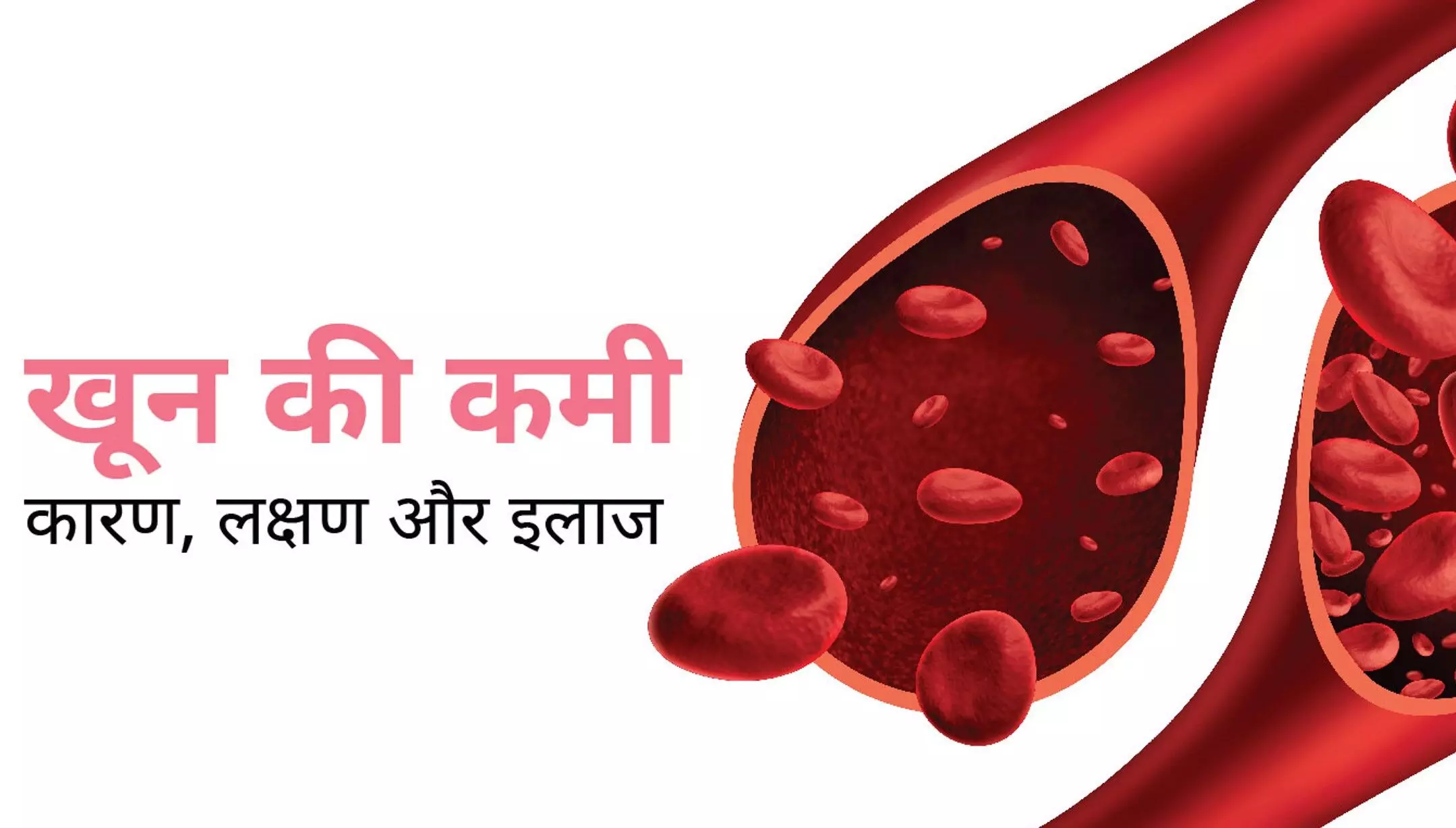 Khoon Ki Kami Ke Lakshan Hindi: शरीर में खून की कमी के लक्षण (Signs and Symptoms of Anemia)