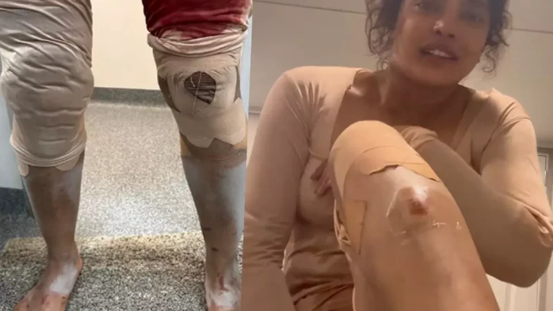 Priyanka Chopra News: छिले हाथ, टूटे पैर… खून से लथपथ दिखीं प्रियंका चोपड़ा, ऐसी हालत देख चिंता में आए देसी गर्ल के फैंस, जानिए क्या…
