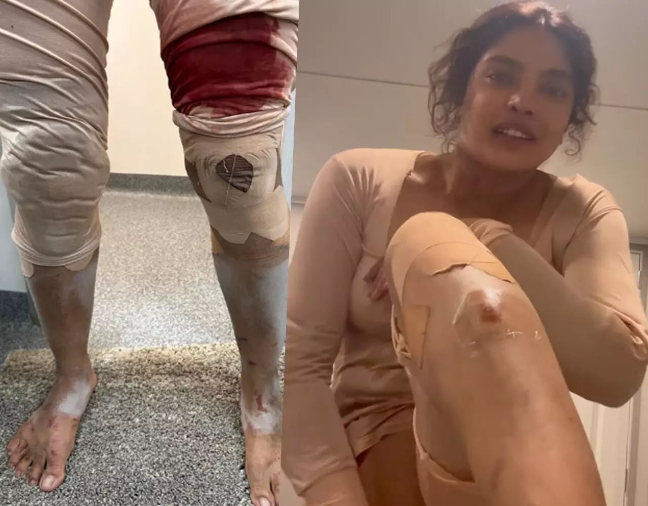 Priyanka Chopra News: छिले हाथ, टूटे पैर… खून से लथपथ दिखीं प्रियंका चोपड़ा, ऐसी हालत देख चिंता में आए देसी गर्ल के फैंस, जानिए क्या…