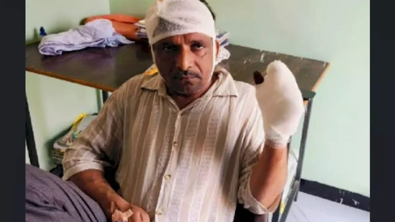 Guna Crime News: गुना में दबंगों ने काटी किसान की उंगलियां, बेटे की हत्या के मामले को रफा-दफा करने का बना रहे थे दबाव