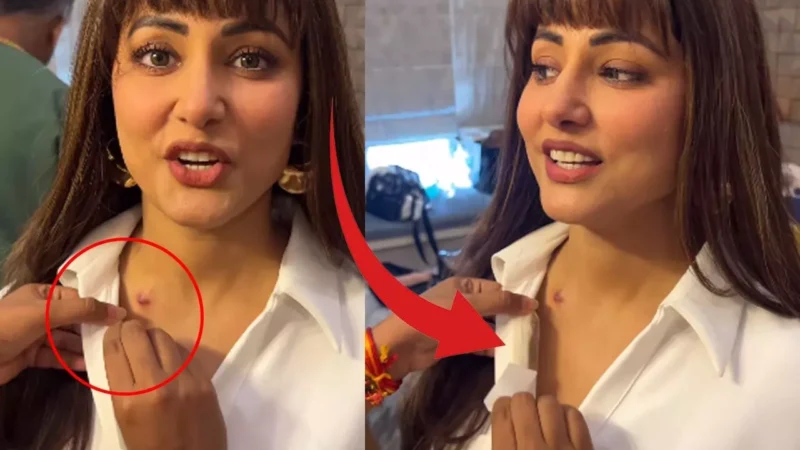 Hina Khan Cancer Video: शूटिंग में कैंसर से पीड़ित हिना खान पहुंची नकली बाल लगाकर, कपड़ों से छिपाए शरीर के निशान, देखिए…
