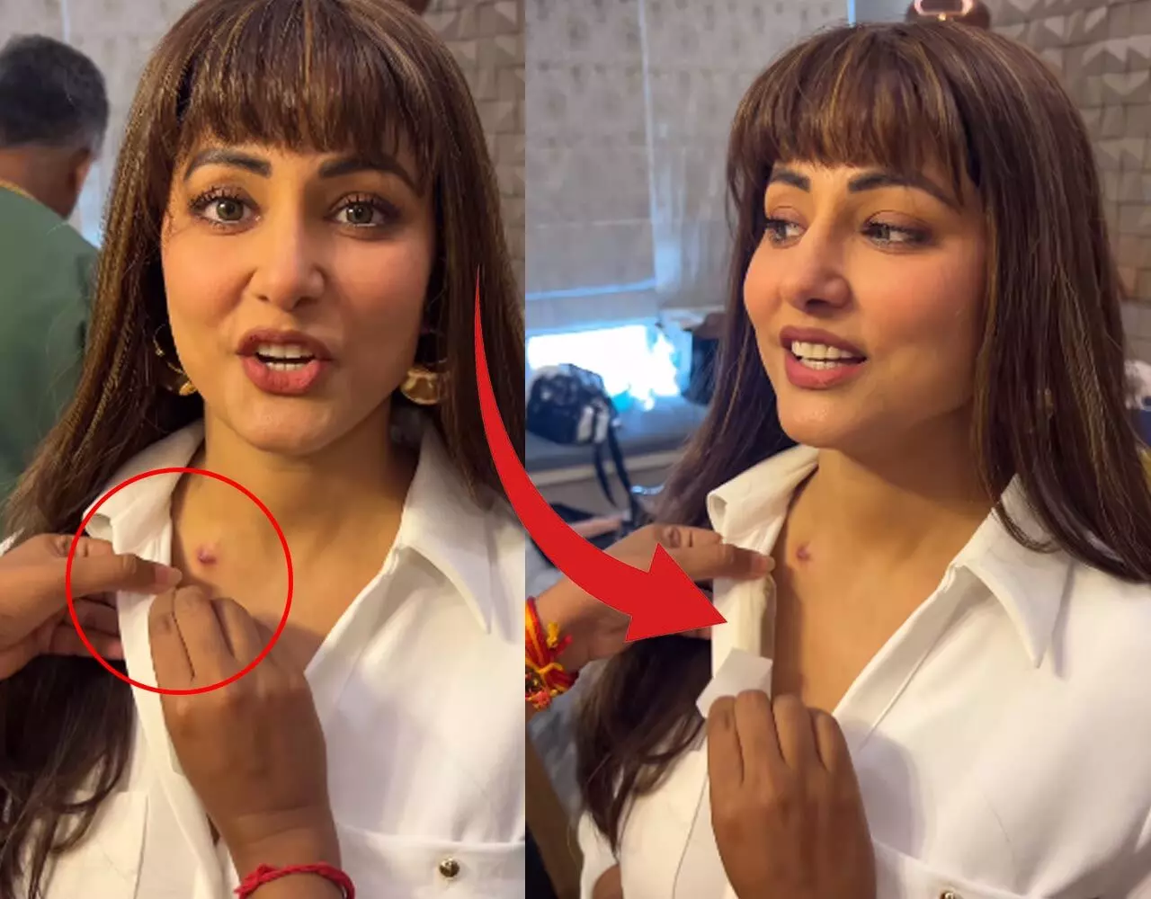 Hina Khan Cancer Video: शूटिंग में कैंसर से पीड़ित हिना खान पहुंची नकली बाल लगाकर, कपड़ों से छिपाए शरीर के निशान, देखिए…