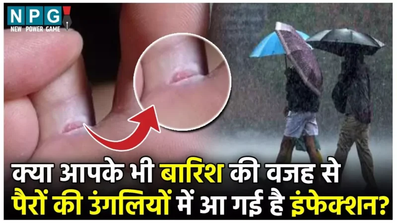 Home Remedies For Foot finger fungal infection: बारिश के मौसम में नमी से पैरों की उंगलियों के बीच हो गया इंफेक्शन? दर्द और तकलीफ़ से राहत देंगे ये घरेलू नुस्खे…