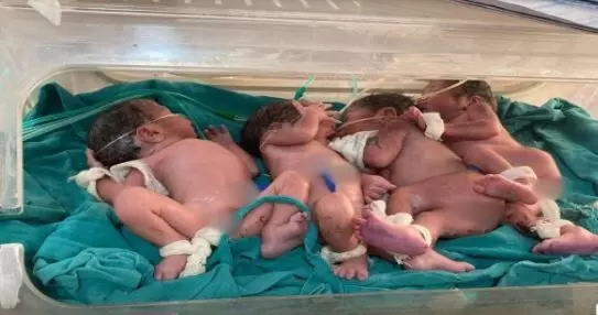 CG में महिला ने दिया 4 बच्चों का जन्म: दो पत्नियों से नहीं हुए बच्चे तो तीसरी शादी की, फिर तीसरी पत्नी ने दिया एक साथ चार बच्चों को जन्म