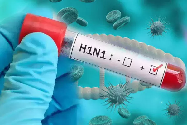 CG Swine-Flu: स्वाइन-फ्लू से बचाव के लिए स्वास्थ्य विभाग ने जारी की हेल्पलाइन नम्बर और एडवाइजरी, चौबीसों घंटे मिलेगी सहायता…