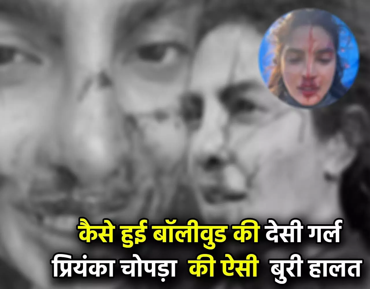 Priyanka Chopra News: खून से लथपथ प्रियंका चोपड़ा, चौंका देने वाली तस्वीर देख कांप जाएगी रूह, जानिए…