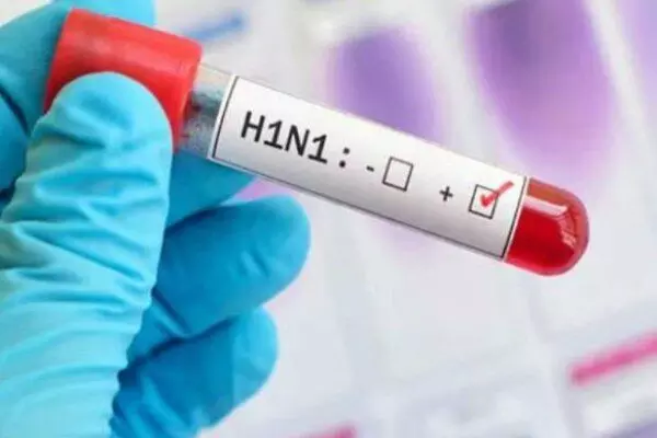Swine Flu: छत्तीसगढ़ में बढ़ने लगे स्वाइन फ्लू के मरीज, जानें लक्षण, बचाव और इलाज