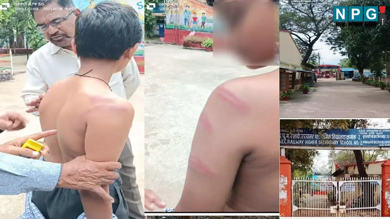 Bilaspur News: स्टूडेंट की बेरहमी से पिटाई, शिक्षक सस्पेंड, जानिए क्या है पूरा मामला…
