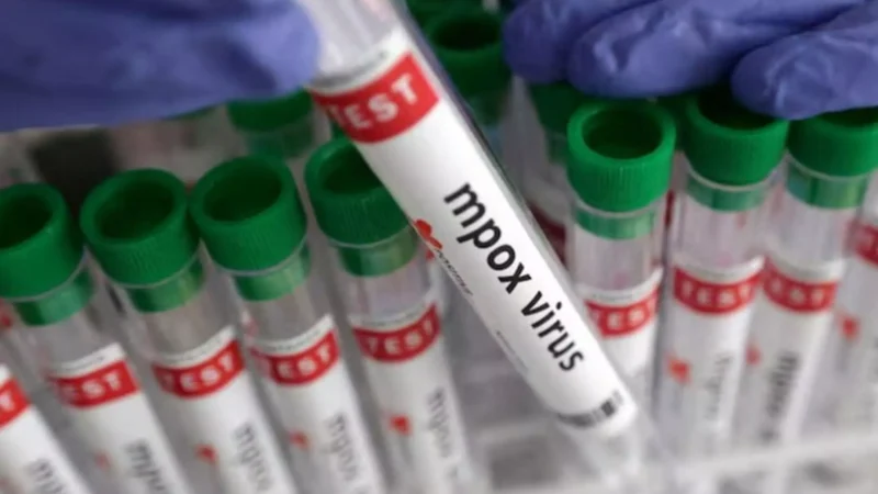 Monkeypox in India: दिल्ली में एमपॉक्स के संदिग्ध मरीज मिलने पर हड़कंप, स्वास्थ्य मंत्रालय ने जारी की एडवाइजरी