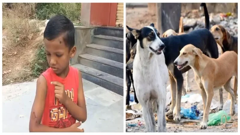 अंबिकापुर: कुत्ते ने बच्चे पर किया बुरी तरह से हमला, सिर, हाथ और पीठ को नोचा, बुजुर्ग ने जान पर खेलकर बचाई जान