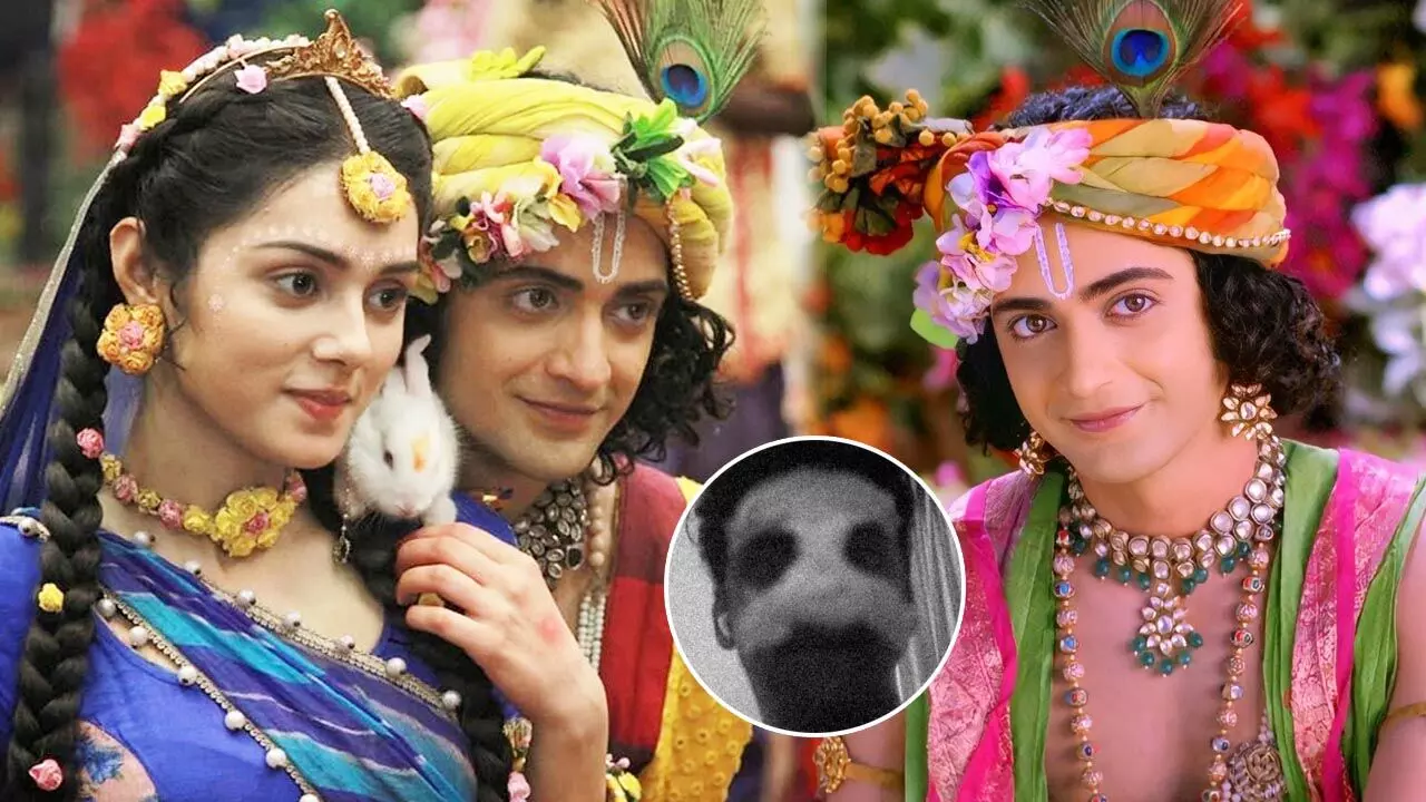 Sumedh Mudgalkar Fracture: "राधाकृष्ण" फेम के कृष्ण मुरली के साथ भयंकर हादसा, टूट गई एक्टर सुमेध की नाक की हड्डी, देखिए…