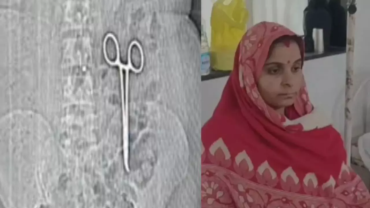 Bhind Hospital News: पेट के अंदर कैंची! महिला ने कराया सीटी स्कैन, तो सामने आई डॉक्टर की लापरवाही, जाने पूरा मामला
