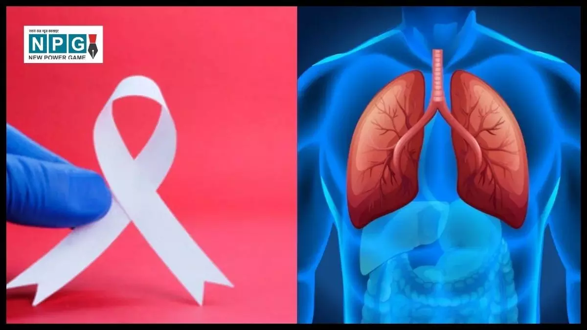 Health Update Cancer: अब यूरिन टेस्ट से फेफड़ों के कैंसर का पता जल्दी और आसानी से