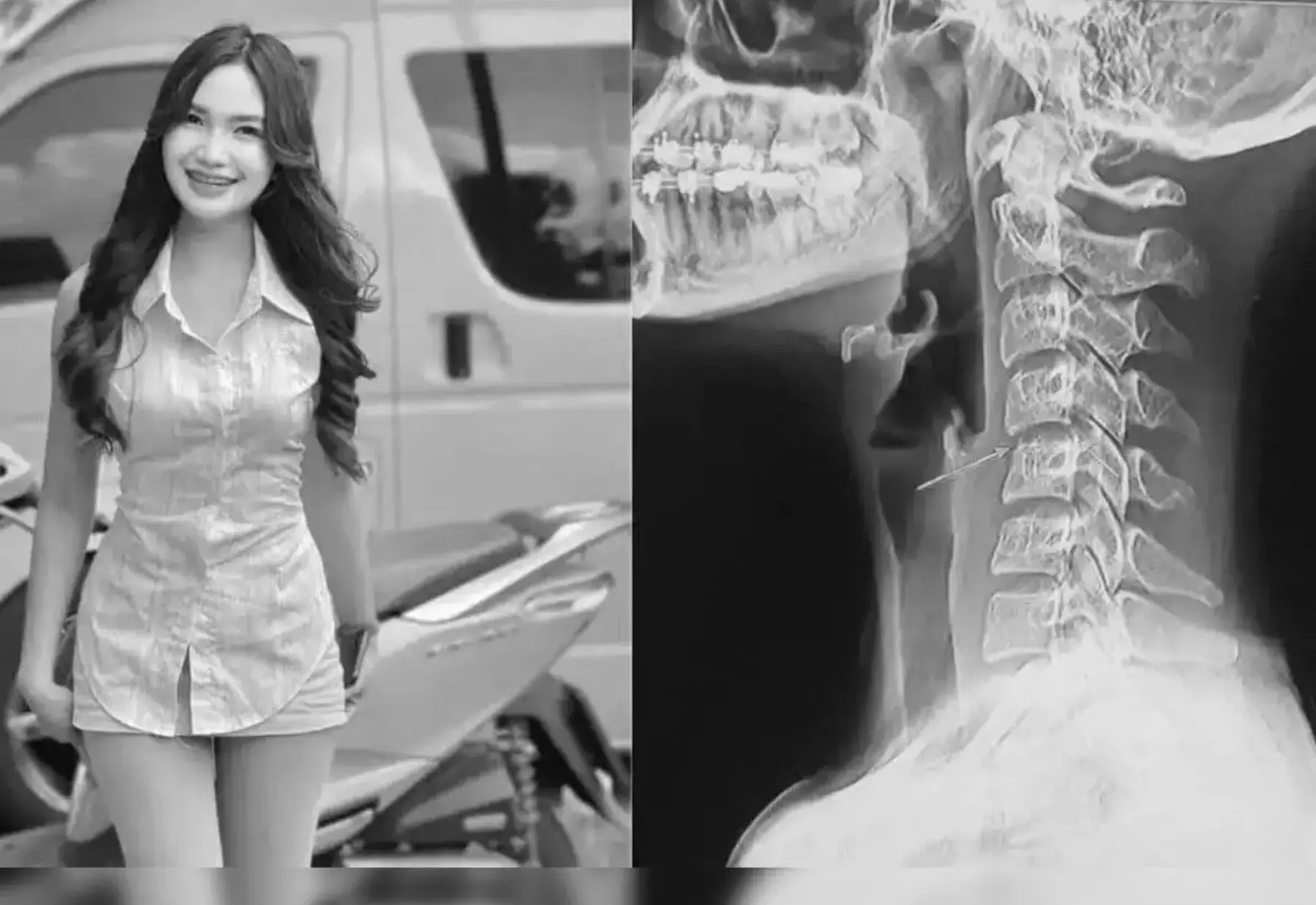 Ping Chayada Dies: मसाज के बाद पॉप सिंगर पिंग चायडा की मौत, जानें क्या है पूरा मामला?