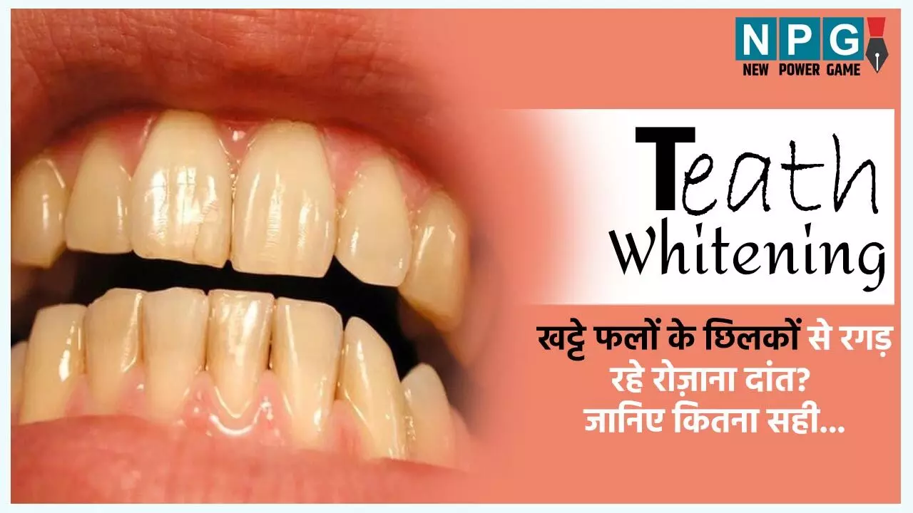 Teath Whitening: क्या आप भी खट्टे फलों के छिलकों से रगड़ रहे रोज़ाना दांत? दांत चमकाने का यह तरीका कितना सही? जानिए डॉक्टर की सलाह…