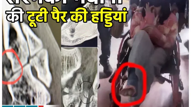 Rashmika Mandanna News: रश्मिका मंदाना की टूटी पैर की हड्ड‍ियां, दर्द में तड़पती हुई दिखी एक्ट्रेस, देखिए फोटो-वीडियो…