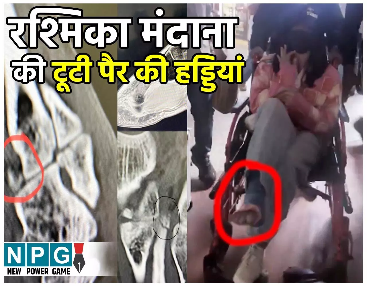 Rashmika Mandanna News: रश्मिका मंदाना की टूटी पैर की हड्डियां, दर्द में तड़पती हुई दिखी एक्ट्रेस, देखिए फोटो-वीडियो…