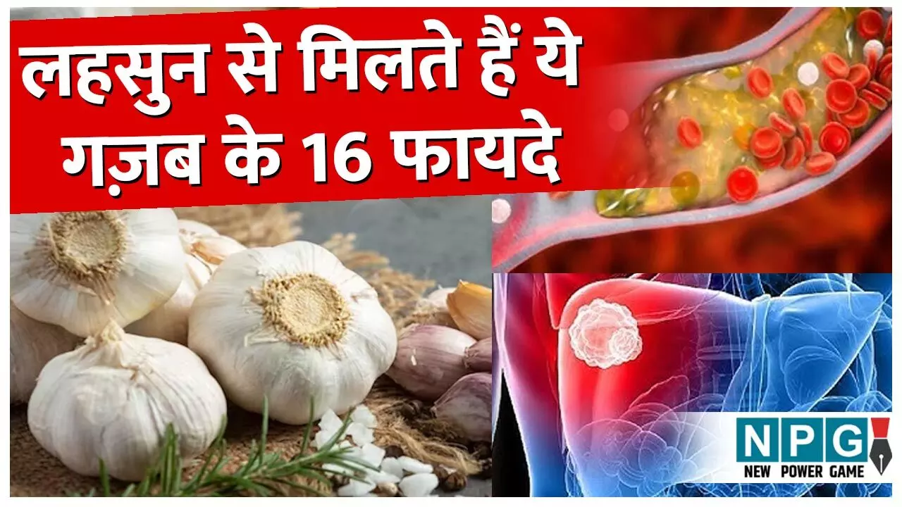 Lahsun Khane Ke 16 Fayde: यूं ही नहीं कहलाता लहसुन 'वंडर हर्ब', रोज़ाना महज दो कलियों के सेवन से मिलते हैं गज़ब के ये 16 फायदे…