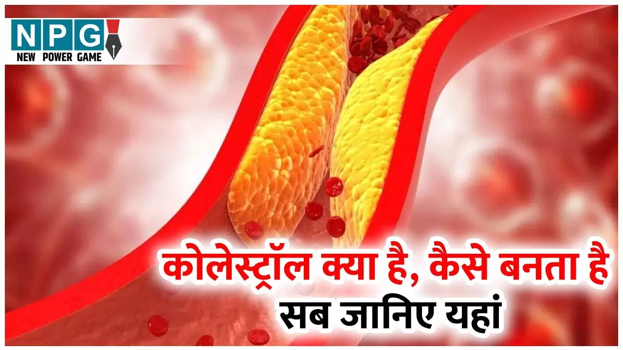 High Cholesterol: कोलेस्ट्राॅल क्या है, कैसे बनता है, क्या खाने से बढ़ता है, कम करने के लिए क्या खाएं? सब जानिए यहां…