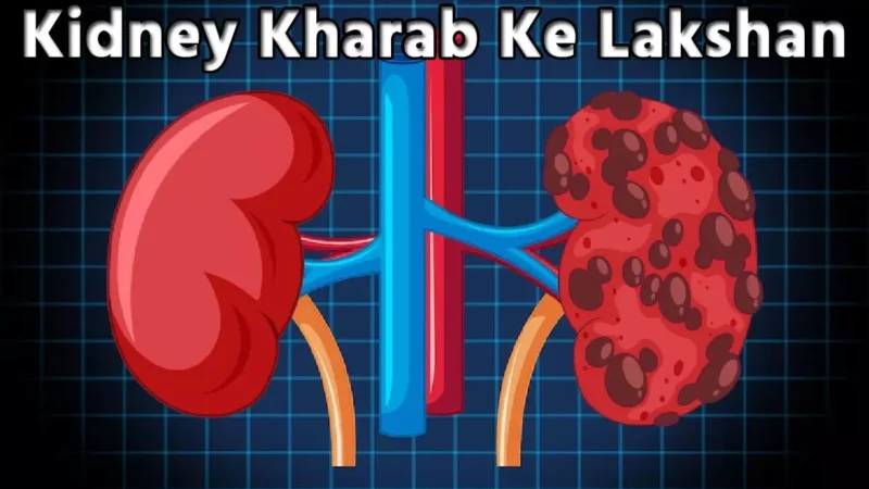 Kidney Kharab Ke Lakshan: क्या है किडनी खराब होने के लक्षण, अगर नही जानते है आप, तो तुरंत जान लीजिए 6 खतरनाक कारण…