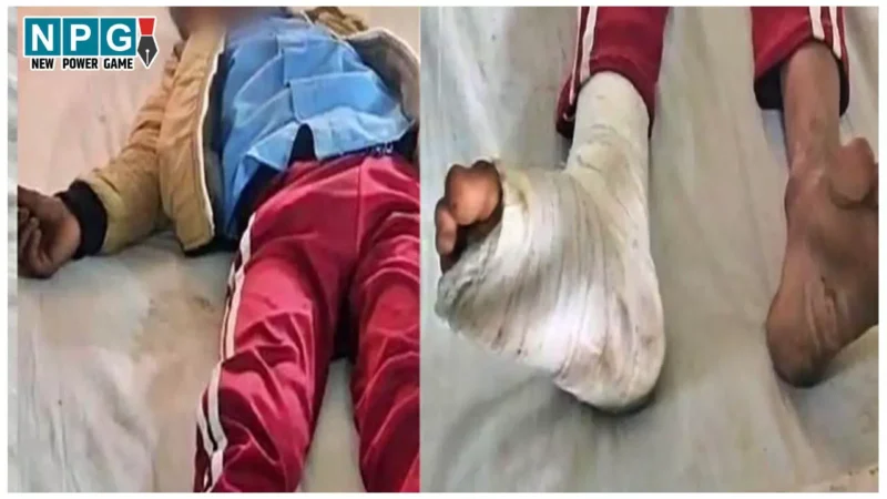Hardoi Teacher News: टीचर है या हैवान! 3rd क्लास के बच्चे को मुर्गा बनाया, फिर पीठ पर बैठकर तोड़ दिया पैर, दर्द से कराहता रहा मासूम…