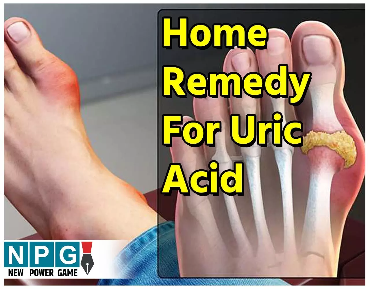 Home Remedy For Uric Acid: ज्वार की रोटी इस सफेद चीज़ में डालकर खाएंगे तो चंद दिनों में यूरिक एसिड हो जाएगा शरीर से बाहर, बहुत आसान है नुस्खा